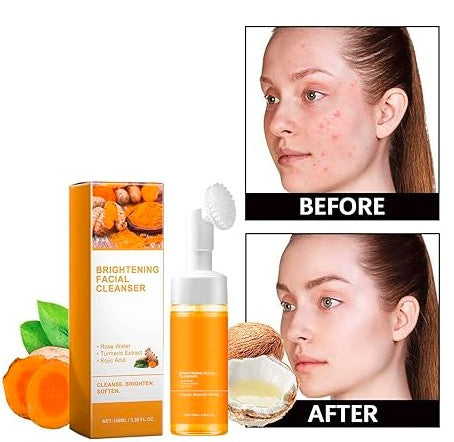 Turmeric Kojic Face Wash, Natural Pack of 2, 150 ml