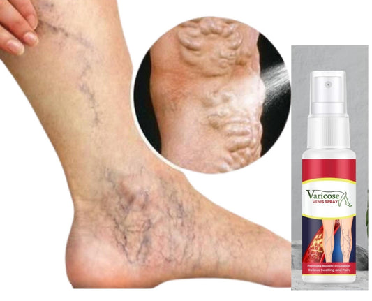 Varicose Veins Relief Spray (Pack of 2)